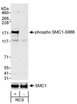 SMC1, p Ser966 Antibody, Novus Biologicals 0.1mL; Unlabeled:Antibodies,