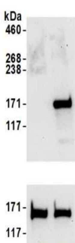 SMC1 Antibody, Novus Biologicals 0.1mg; Unlabeled:Antibodies, Polyclonal