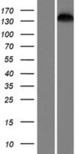 Novus Biologicals™ SMC1L2 Overexpression Lysate