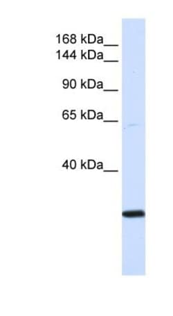 SMC2 Antibody, Novus Biologicals 100&mu;L; Unlabeled:Antibodies, Polyclonal