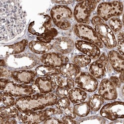 TATDN1 Antibody, Novus Biologicals:Antibodies:Primary Antibodies