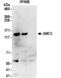 SMC5 Antibody, Novus Biologicals 0.1mg; Unlabeled:Antibodies, Polyclonal