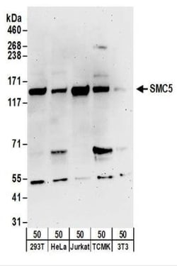 SMC5 Antibody, Novus Biologicals 0.1mg; Unlabeled:Antibodies, Polyclonal