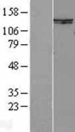 Novus Biologicals&trade;&nbsp;SMC6L1 Overexpression Lysate