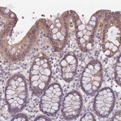 SMC6L1 Antibody, Novus Biologicals 25 &mu;L, Unlabeled:Antibodies, Polyclonal