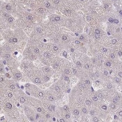SMC6L1 Antibody, Novus Biologicals 25 &mu;L, Unlabeled:Antibodies, Polyclonal