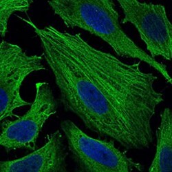 SMCP Antibody (5C10D8) - BSA Free, Novus Biologicals 0.1mL; Unlabeled:Antibodies,
