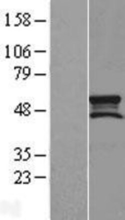 Novus Biologicals&trade;&nbsp;SMCR7L Overexpression Lysate