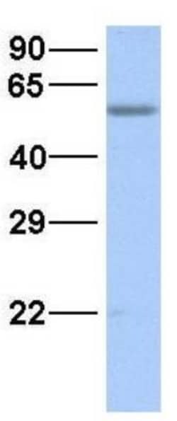 SMCR7L Antibody, Novus Biologicals 0.05mg; Unlabeled:Antibodies, Polyclonal
