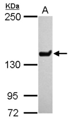 SMCX Antibody, Novus Biologicals 0.1mL; Unlabeled:Antibodies, Polyclonal