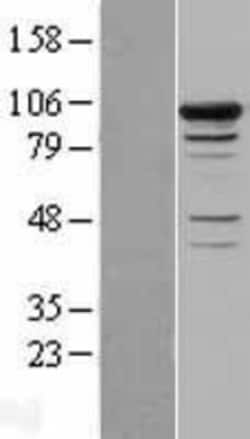 Novus Biologicals™ Smek1 Overexpression Lysate