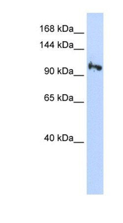 SMG5 Antibody, Novus Biologicals:Antibodies:Primary Antibodies