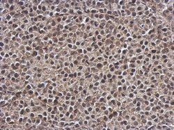 SMG7 Antibody, Novus Biologicals 0.1mL; Unlabeled:Antibodies, Polyclonal