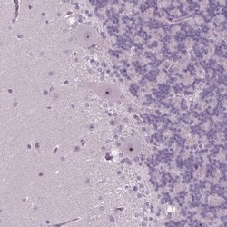 SMIM18 Antibody, Novus Biologicals 25 &mu;L, Unlabeled:Antibodies, Polyclonal