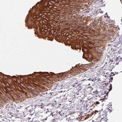 SMLR1 Antibody, Novus Biologicals 0.1mL; Unlabeled:Antibodies, Polyclonal