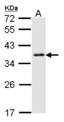 SMN Antibody, Novus Biologicals 0.1mg; Unlabeled:Antibodies, Polyclonal