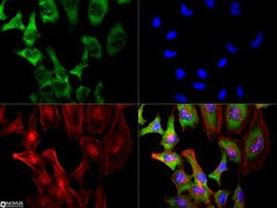 SMN Antibody (2B1), Novus Biologicals 0.1mL; Unlabeled:Antikörper