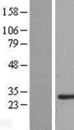 Novus Biologicals&trade;&nbsp;SMNDC1 Overexpression Lysate