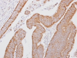 SMOC-1 Antibody, Novus Biologicals 0.1mL; Unlabeled:Antibodies, Polyclonal