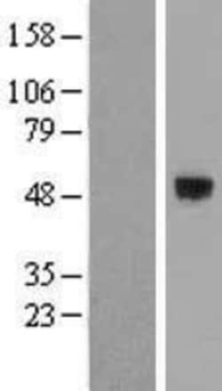 Novus Biologicals&trade;&nbsp;SMOC-1 Overexpression Lysate