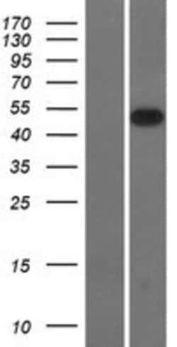Novus Biologicals&trade;&nbsp;SMOC-2 Overexpression Lysate