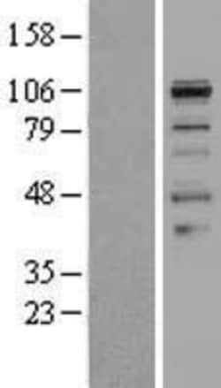 Novus Biologicals&trade;&nbsp;Smoothelin Overexpression Lysate