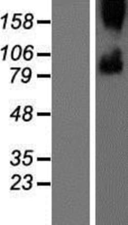 Novus Biologicals&trade;&nbsp;Smoothened Overexpression Lysate