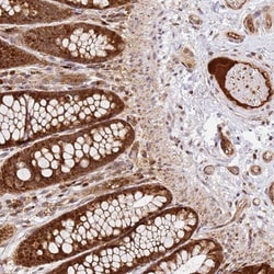 SMOX Antibody, Novus Biologicals 25 &mu;L, Unlabeled:Antibodies, Polyclonal