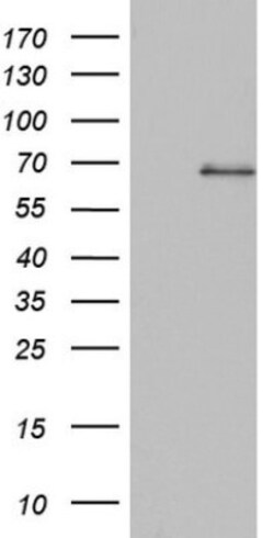 SMPD1 Antibody (OTI3H7), Novus Biologicals 0.1mL; Unlabeled:Antibodies,