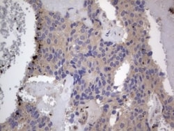 SMPD1 Antibody (OTI3H7), Novus Biologicals 0.1mL; Unlabeled:Antibodies,