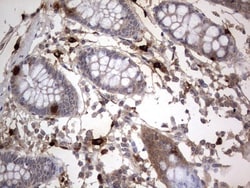SMPD1 Antibody (OTI3H7), Novus Biologicals 0.1mL; Unlabeled:Antibodies,