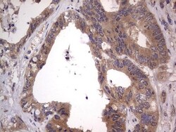 SMPD1 Antibody (OTI3H7), Novus Biologicals 0.1mL; Unlabeled:Antibodies,