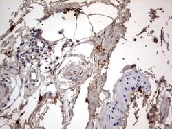 SMPD1 Antibody (OTI3H7), Novus Biologicals 0.1mL; Unlabeled:Antibodies,