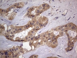 SMPD1 Antibody (OTI3H7), Novus Biologicals 0.1mL; Unlabeled:Antibodies,