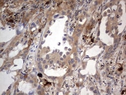 SMPD1 Antibody (OTI3H7), Novus Biologicals 0.1mL; Unlabeled:Antibodies,