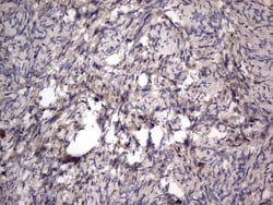 SMPD1 Antibody (OTI3H7), Novus Biologicals 0.1mL; Unlabeled:Antibodies,