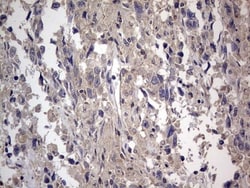 SMPD1 Antibody (OTI3H7), Novus Biologicals 0.1mL; Unlabeled:Antibodies,