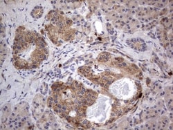 SMPD1 Antibody (OTI3H7), Novus Biologicals 0.1mL; Unlabeled:Antibodies,