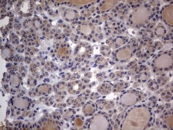 SMPD1 Antibody (OTI3H7), Novus Biologicals 0.1mL; Unlabeled:Antibodies,
