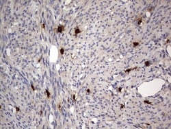 SMPD1 Antibody (OTI3H7), Novus Biologicals 0.1mL; Unlabeled:Antibodies,