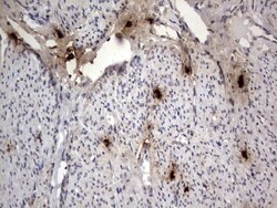 SMPD1 Antibody (OTI3H7), Novus Biologicals 0.1mL; Unlabeled:Antibodies,