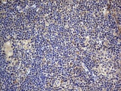 SMPD1 Antibody (OTI3H7), Novus Biologicals 0.1mL; Unlabeled:Antibodies,