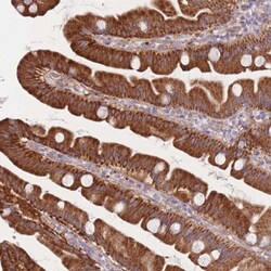 SMPD4 Antibody, Novus Biologicals 25 &mu;L | Buy Online | Novus Biologicals | Fisher Scientific