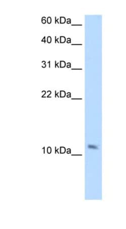 SMPX Antibody, Novus Biologicals 100 &mu;L | Buy Online | Novus Biologicals | Fisher Scientific