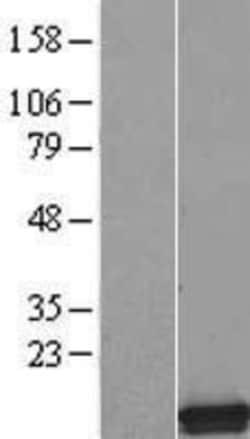 Novus Biologicals&trade;&nbsp;SMPX Overexpression Lysate