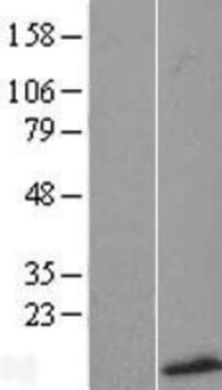 Novus Biologicals™ SMR3B Overexpression Lysate