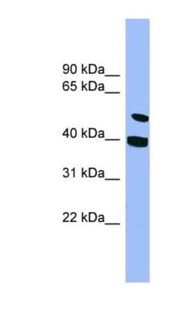 smu1 Antibody, Novus Biologicals 100 &mu;L | Buy Online | Novus Biologicals | Fisher Scientific