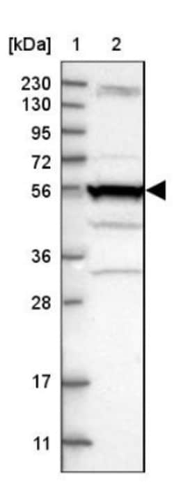 smu1 Antibody, Novus Biologicals 25 &mu;L | Buy Online | Novus Biologicals | Fisher Scientific