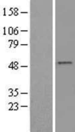 Novus Biologicals&trade;&nbsp;SMYD2 Overexpression Lysate