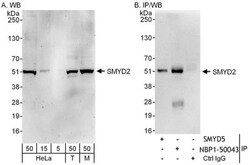 SMYD2 Antibody, Novus Biologicals 0.1mg; Unlabeled:Antibodies, Polyclonal